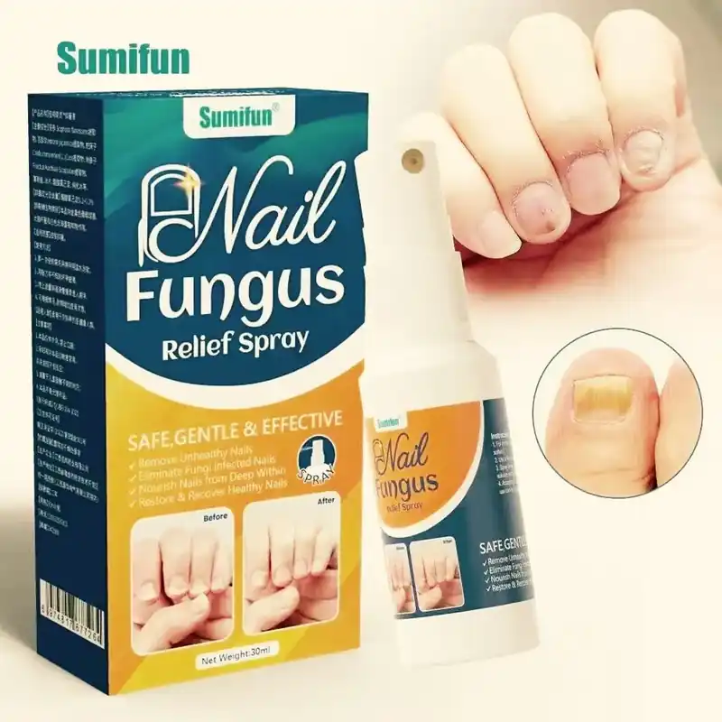 Sumifun Spray na grzybicę paznokci 30ml Wyprzedaż